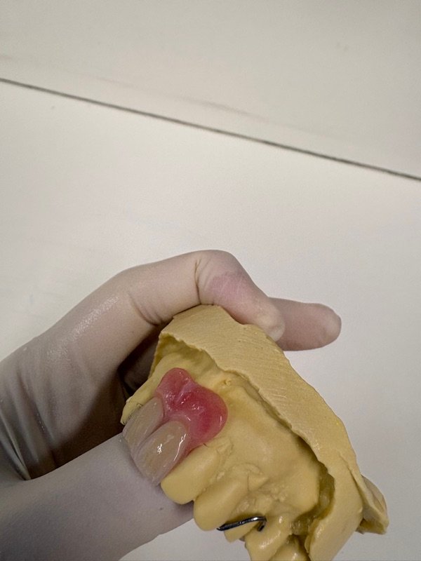 Custom denture samples crafted in Oak Park on-site dental laboratory Melbourne