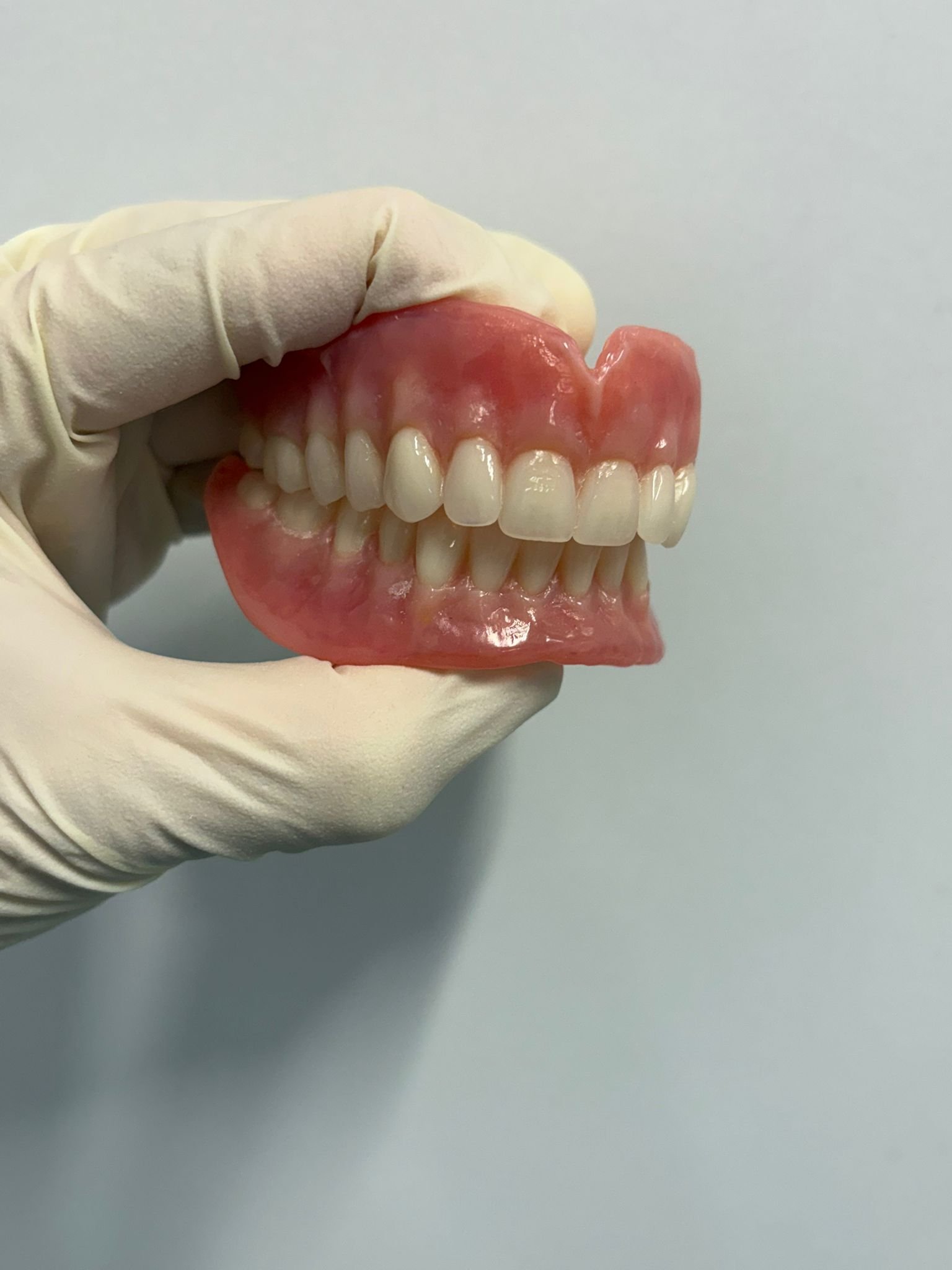 Partial Dentures